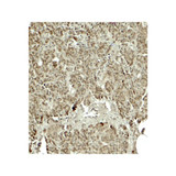 ProSci 7971 KIRREL2 Antibody