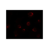 ProSci 8015 P2RX7 Antibody