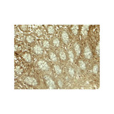 ProSci 8053 LIMA1 Antibody