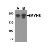ProSci 8081 MYH8 Antibody