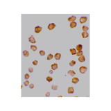 ProSci 2021 DcR2 Antibody