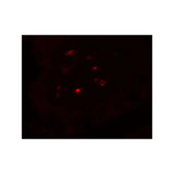 ProSci 8101 CTHRC1 Antibody