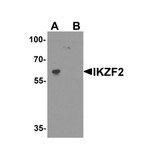 ProSci 8117 IKZF2 Antibody