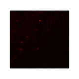 ProSci 8117 IKZF2 Antibody