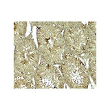 ProSci 8123 SOX4 Antibody