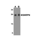 ProSci 8155 SNRPN Antibody