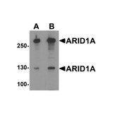 ProSci 8173 ARID1A Antibody