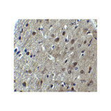 ProSci 8173 ARID1A Antibody