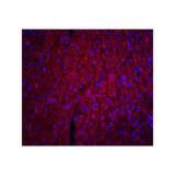 ProSci 8173 ARID1A Antibody