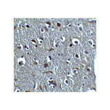 ProSci 8181 RLN3 Antibody
