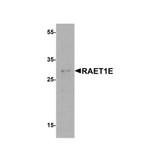 ProSci 8193 RAET1E Antibody