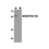 ProSci 8283 DEPDC1B Antibody