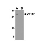 ProSci 8289 VTI1b Antibody