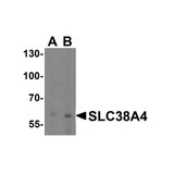 ProSci 8343 SLC38A4 Antibody