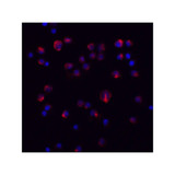 ProSci 8453 IL-11 Antibody