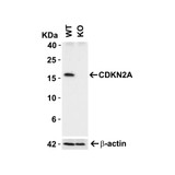 ProSci 8975 CDKN2A Antibody