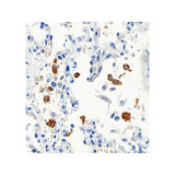 ProSci 9099 SARS-CoV-2 (COVID-19) Nucleocapsid Antibody