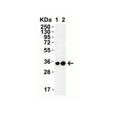 ProSci 9151 SARS-CoV-2 (COVID-19) 3CL-PRO (NSP5) Antibody