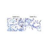 ProSci 9181 SARS-CoV-2 (COVID-19) NSP13 (Helicase) Antibody