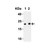 ProSci 9281 SARS-CoV-2 (COVID-19) ORF3b Antibody