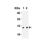 ProSci 9289 SARS-CoV-2 (COVID-19) ORF8 Antibody