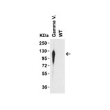 ProSci 9573 SARS-CoV-2 Spike P26S Antibody