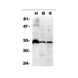 ProSci 2140 DcR3 Antibody