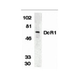 ProSci 2179 DcR1 Antibody