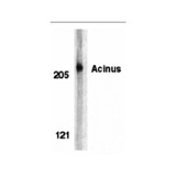 ProSci 2241 Acinus Antibody
