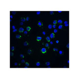 ProSci 2241 Acinus Antibody