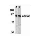 ProSci 2247 BACE2 Antibody