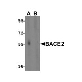 ProSci 2249 BACE2 Antibody
