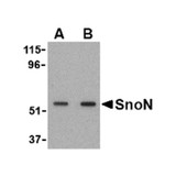 ProSci 2255 SnoN Antibody
