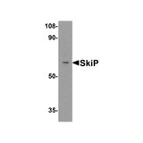 ProSci 2261 SkiP Antibody
