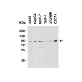 ProSci 2265 Nephrin Antibody
