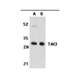 ProSci 2395 TACI Antibody