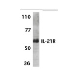 ProSci 2471 IL-21 Receptor Antibody