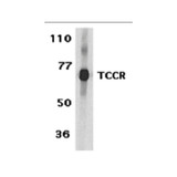 ProSci 2481 TCCR Antibody