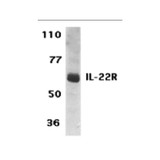 ProSci 2489 IL-22 Receptor Antibody