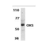 ProSci 2499 CIKS Antibody