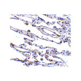 ProSci 2499 CIKS Antibody