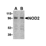 ProSci 2513 NOD2 Antibody