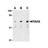 ProSci 3073 PAK6 Antibody
