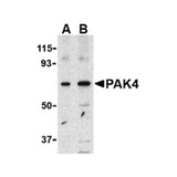 ProSci 3077 PAK4 Antibody