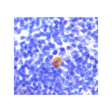 ProSci 3189 CARMA1 Antibody