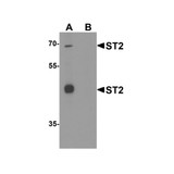 ProSci 3363 ST2 Antibody