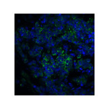 ProSci 3363 ST2 Antibody