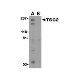ProSci 3507 TSC2 Antibody