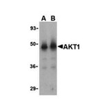 ProSci 3519 Akt1 Antibody