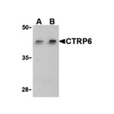 ProSci 3575 CTRP6 Antibody